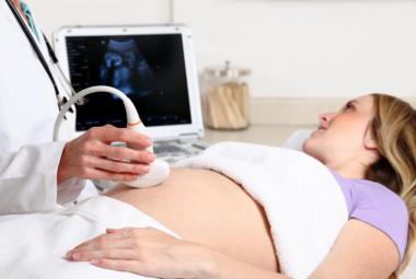 Pregnancy Ultrasound