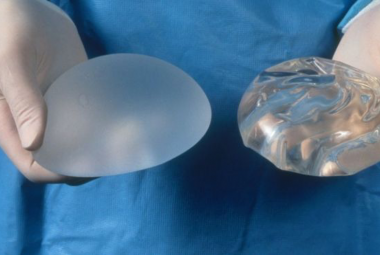 Surgeon holding breast implants