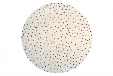 Brucella melitensis, the most common cause of Brucellosis in infants